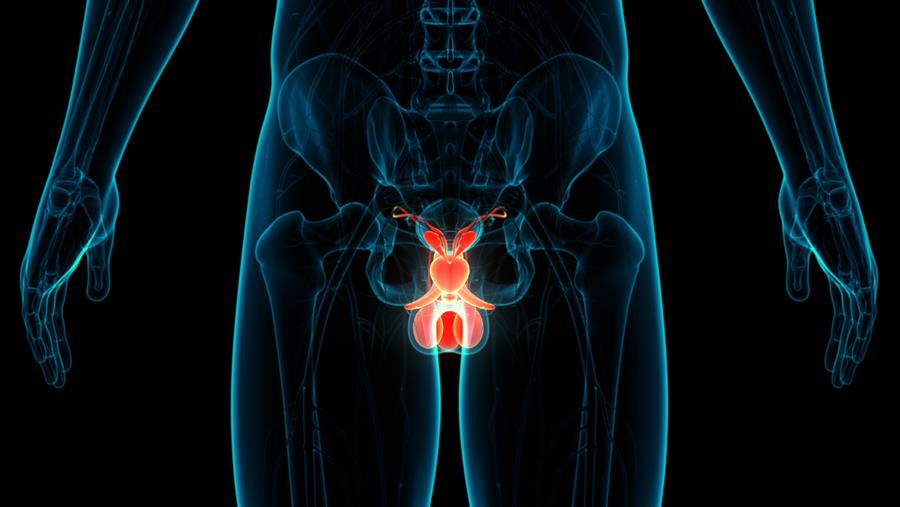 Cancer testiculaire : Un biomarqueur de détection des rechutes