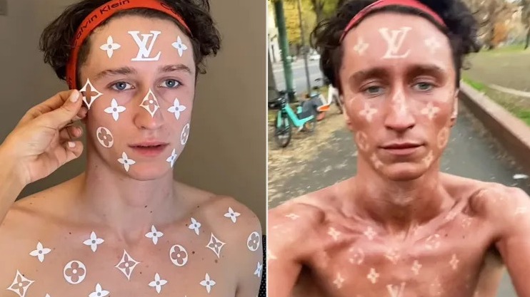 Euromelanoma wil online 'bullshit' over huidkanker bestrijden