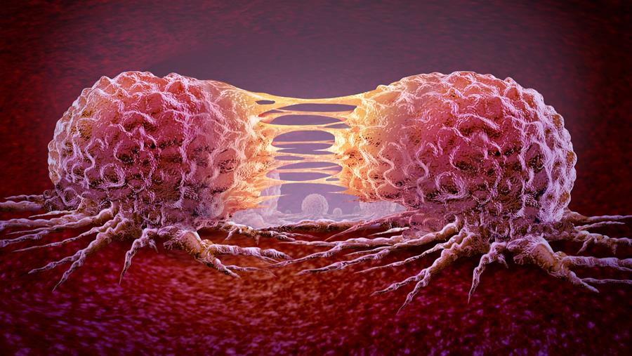 Cancer : une percée pour stopper la dissémination métastatique